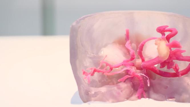 智慧现代医学3D打印成品