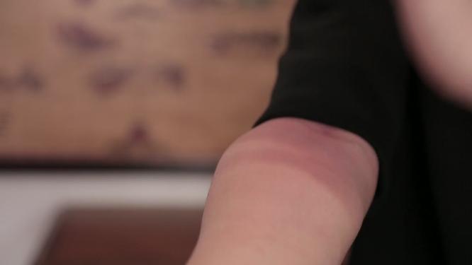 模特胳膊上肢保健操