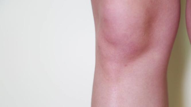 女性腿部穴位按摩膝盖