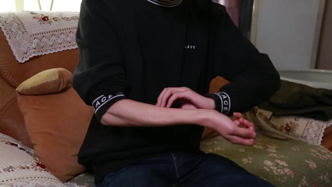 胳膊过敏荨麻疹丘疹